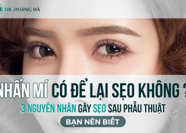 Nhấn mí có để lại sẹo không? 3 nguyên nhân gây sẹo sau phẫu thuật bạn nên biết