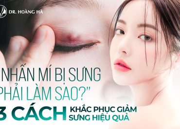 Nhấn mí bị sưng phải làm sao? 3 Cách khắc phục giảm sưng hiệu quả