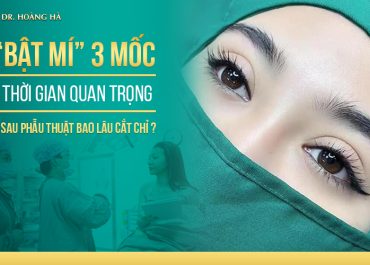 Sau phẫu thuật bao lâu cắt chỉ? 3 mốc thời gian quan trọng