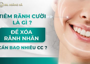 Tiêm rãnh cười là gì? Cần bao nhiêu cc để xóa rãnh nhăn - BS giải đáp