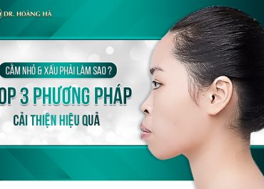 Cằm nhỏ, xấu phải làm sao? Top 3 phương pháp cải thiện hiệu quả