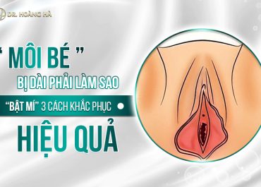 Môi bé bị dài phải làm sao? “bật mí” 3 cách khắc phục hiệu quả