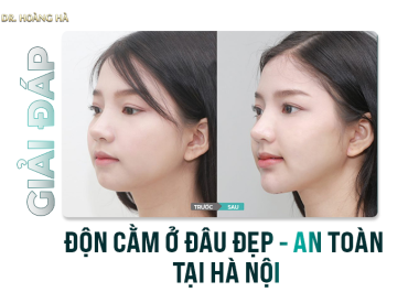 Độn cằm ở đâu đẹp - AN TOÀN tại Hà Nội “Giải đáp”