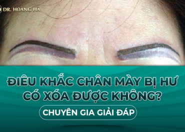 Điêu khắc chân mày bị hư có xóa được không? - Chuyên gia giải đáp