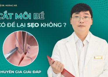 Cắt môi bé có để lại sẹo không? Chuyên gia giải đáp