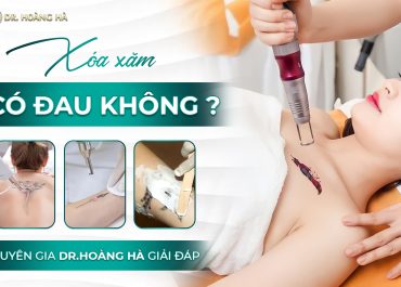 Xóa xăm có đau không? Chuyên gia Dr Hoàng Hà giải đáp