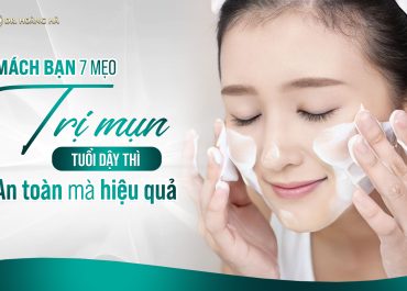 Mách bạn 7 mẹo trị mụn tuổi dậy thì an toàn mà hiệu quả