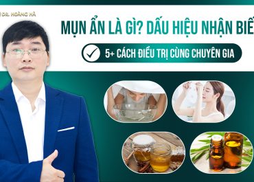 Mụn ẩn là gì? Dấu hiệu nhận biết và 5+ cách điều trị cùng chuyên gia