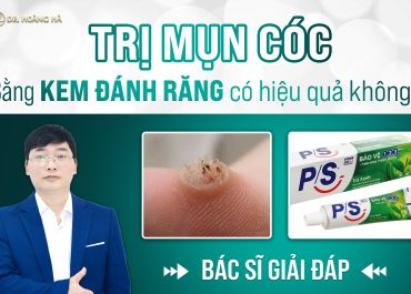 Trị mụn cóc bằng kem đánh răng có hiệu quả không? Bác sĩ giải đáp