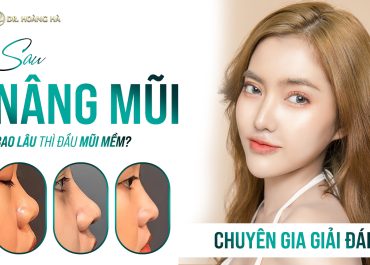 Sau nâng mũi bao lâu thì đầu mũi mềm? Chuyên gia giải đáp