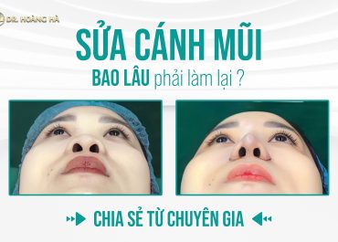 Sửa cánh mũi bao lâu phải làm lại? Chia sẻ từ chuyên gia