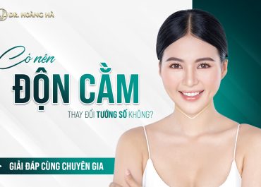 Có nên độn cằm thay đổi tướng số không? Giải đáp cùng chuyên gia