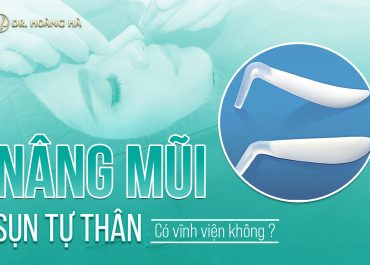 Nâng mũi sụn tự thân có vĩnh viễn không? Chuyên gia giải đáp