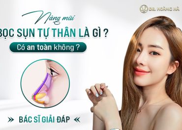 Nâng mũi bọc sụn tự thân là gì? Có an toàn không - Bs giải đáp