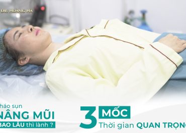 Tháo sụn nâng mũi bao lâu thì lành? 3 Môc thời gian quan trọng