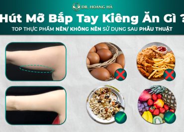 Hút mỡ bắp tay kiêng ăn gì? Top thực phẩm nên/không sử dụng sau phẫu thuật