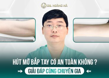 Hút mỡ bắp tay có an toàn không? Giải đáp cùng chuyên gia