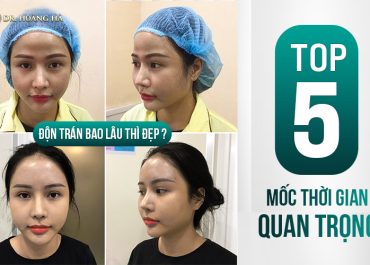 Độn trán bao lâu thì đẹp? Top 5 Mốc thời gian quan trọng