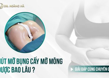 Hút mỡ bụng cấy mỡ mông được bao lâu? Giải đáp cùng chuyên gia