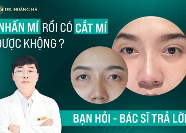 Nhấn mí rồi có cắt mí được không? Bạn hỏi - Bác sĩ giải đáp