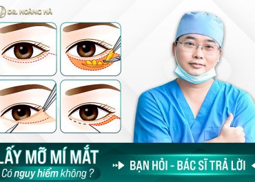 Lấy mỡ mí mắt có nguy hiểm không? Bạn hỏi - bác sĩ giải đáp