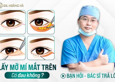 Lấy mỡ mí mắt trên có đau không? Bạn hỏi - Bác sĩ giải đáp