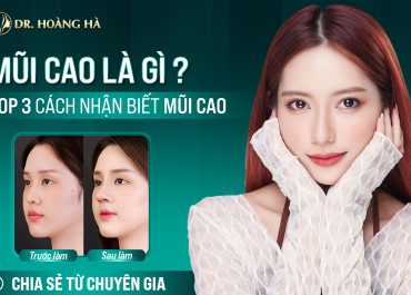 Mũi cao là gì? Top 3 cách nhận biết mũi cao - Chia sẻ từ chuyên gia