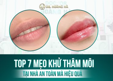 Top 7 mẹo Khử thâm môi tại Nhà AN TOÀN MÀ HIỆU QUẢ