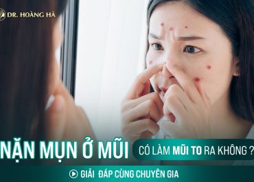 Nặn mụn ở mũi có làm mũi to ra không? Giải đáp cùng chuyên gia