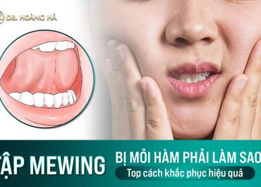 Tập mewing bị mỏi hàm phải làm sao? Top Cách khắc phục hiệu quả