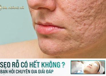 Sẹo rỗ có hết không? Bạn hỏi - Chuyên gia giải đáp