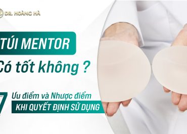 Túi Mentor có tốt không? 7+ Ưu/nhược điểm khi quyết định sử dụng