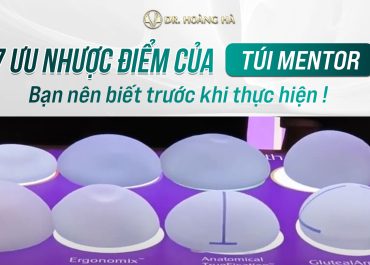 7+ Ưu nhược điểm của túi mentor - Chia sẻ từ chuyên gia