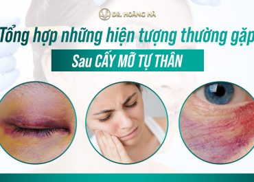 Tổng hợp những hiện tượng có thể gặp sau cấy mỡ tự thân