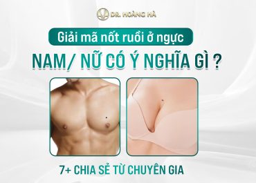 Giải mã nốt ruồi ở ngực nam/nữ có ý nghĩa gì? 7+ chia sẻ từ chuyên gia