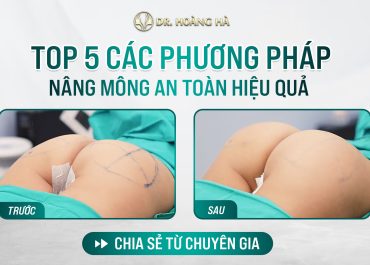 Top 5 các phương pháp nâng mông an toàn hiệu quả - Chia sẻ từ chuyên gia