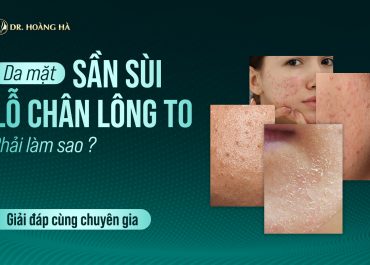 Da mặt sần sùi lỗ chân lông to phải làm sao? Giải đáp cùng chuyên gia