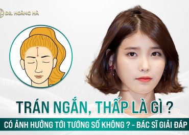 Trán ngắn, thấp là gì, có ảnh hưởng tới tướng số không? BS giải đáp