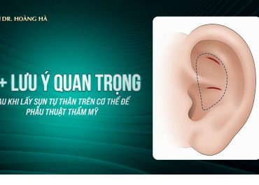 7+ Lưu ý quan trọng sau khi lấy sụn tự thân trên cơ thể để phẫu thuật thẩm mỹ