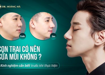 Con trai có nên sửa mũi không? Kinh nghiệm cần biết trước khi thực hiện