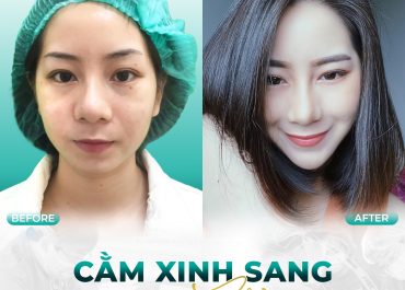 CẰM XINH SANG - CHUẨN TỈ LỆ VÀNG