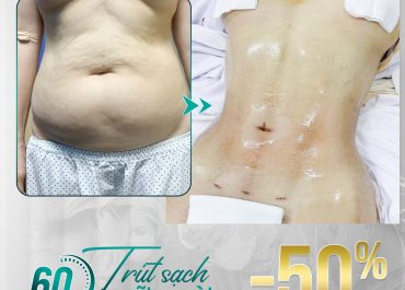 60 PHÚT TRÚT SẠCH MỠ THỪA - TỰ TIN KHOE DÁNG NUỘT NÀ