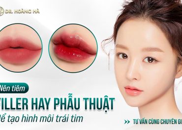 Nên tiêm filler hay phẫu thuật để tạo hình môi trái tim? Tư vấn cùng chuyên gia