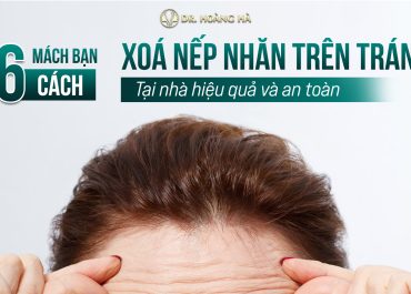 Mách bạn 6 cách xoá nếp nhăn trên trán tại nhà hiệu quả và an toàn 