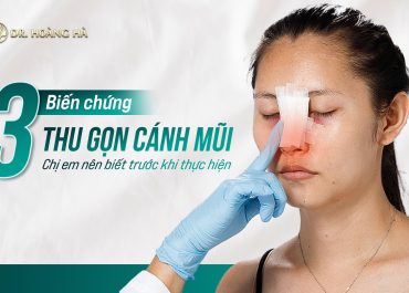 3 biến chứng thu gọn cánh mũi chị em nên biết trước khi thực hiện