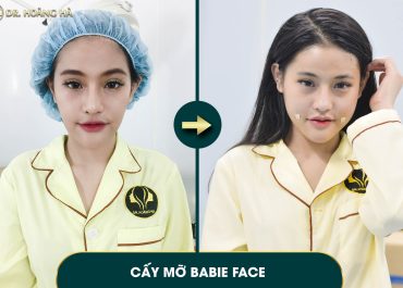 Sau khi cấy mỡ có được trang điểm không? Câu trả lời từ chuyên gia 