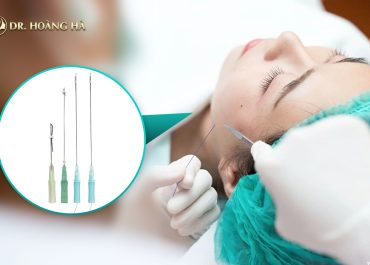 Mách bạn 7+ cách chăm sóc da sau căng chỉ collagen giúp kéo dài hiệu quả trẻ hoá 