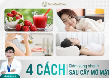 4 cách giảm sưng nhanh sau cấy mỡ mặt? Bật mí từ bác sĩ