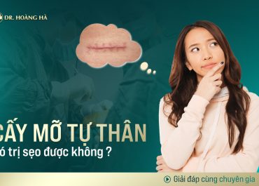 Cấy mỡ tự thân có trị được sẹo không? Giải đáp cùng chuyên gia