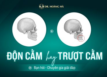 Nên độn cằm hay trượt cằm? Giải đáp cùng chuyên gia